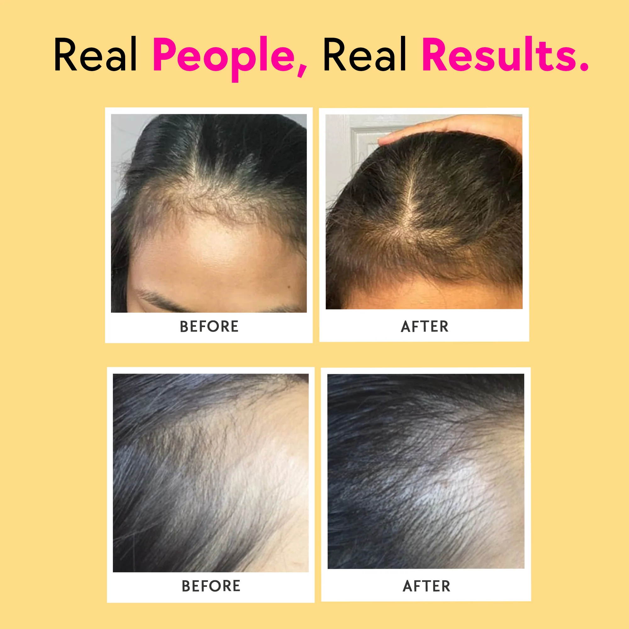 Bounce – Keratin Boosters & Biotin for Hair Growth & Hair Fall Control - Mango - Image 5