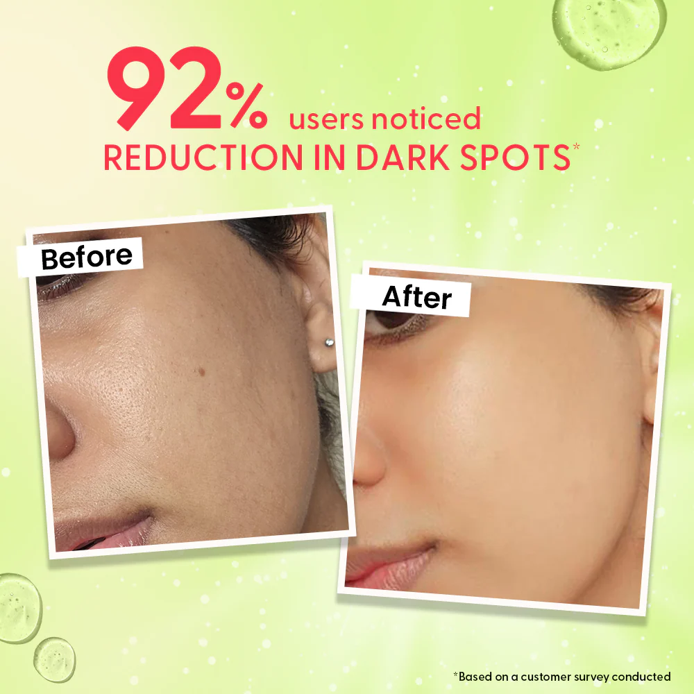 Korean Brightening Serum & Weight Loss Combo - Image 2